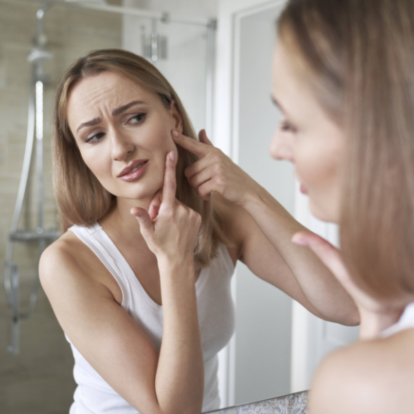 Acne - non-prescription