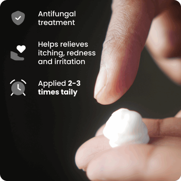 Clotrimazole 1% Cream